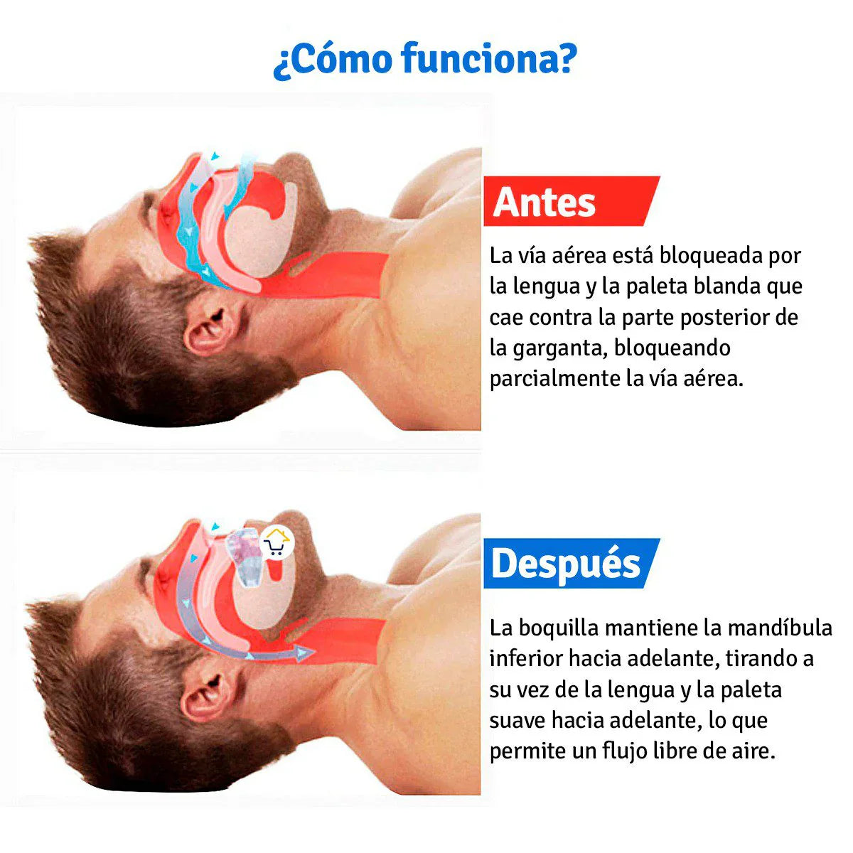Anti ronquidos Bucal RoncaStop™